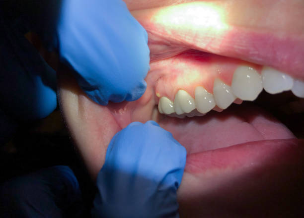 Best Walk-In Emergency Dentist in Warsaw, IN